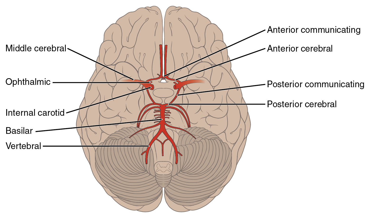 Aneurysm Locations - Brain Basics